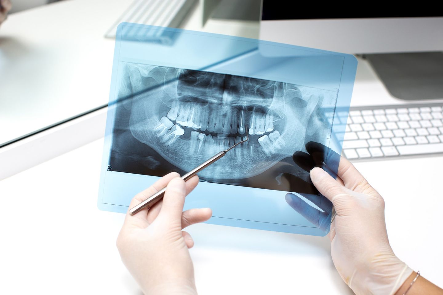 Czy należy się obawiać stomatologicznych zabiegów chirurgicznych?